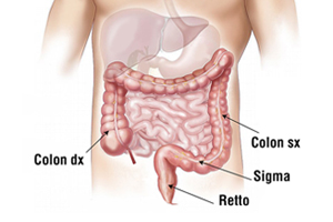 Chirurgia del colon e del retto
